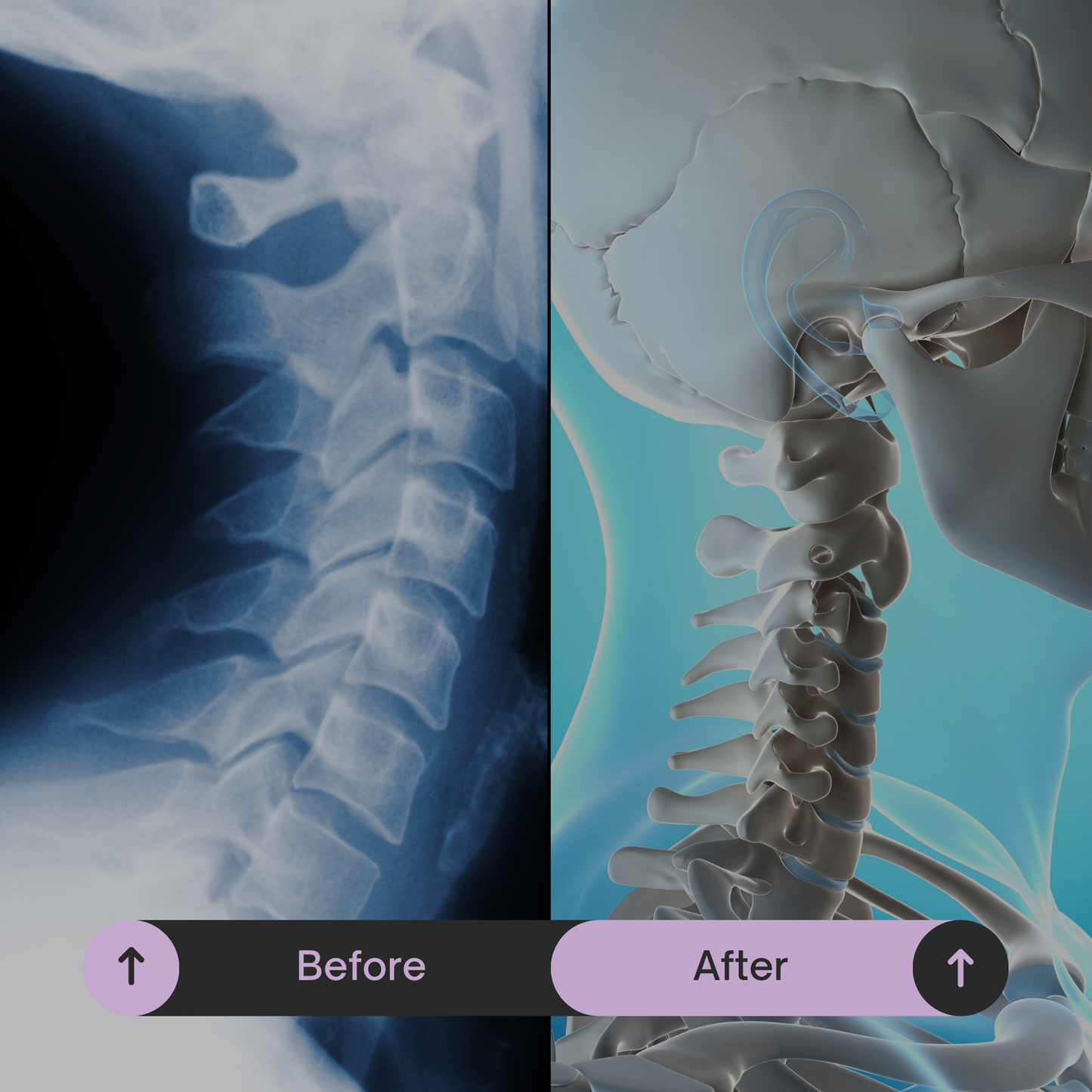 Twiia - Anti Snore Neck Support