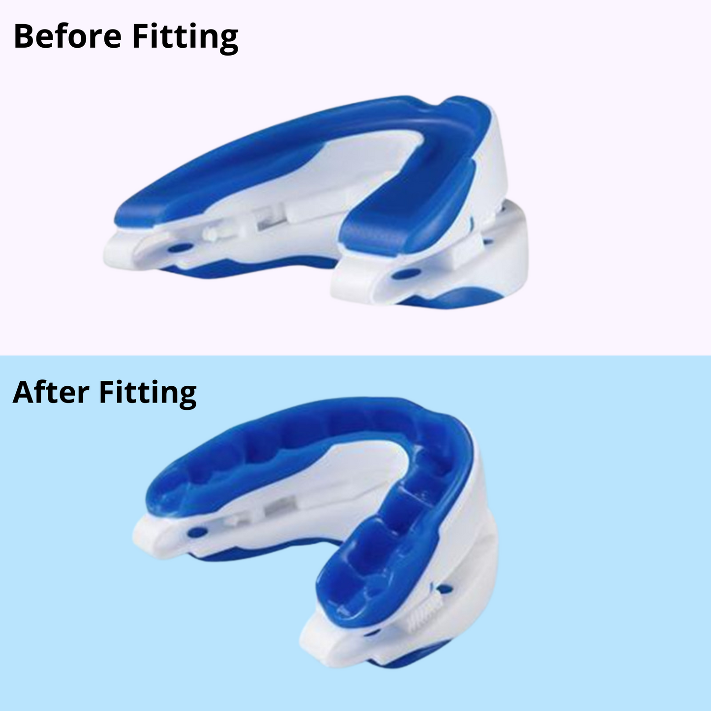 Twiia Mouth Guard - Sleep Apnea & Anti-Snoring