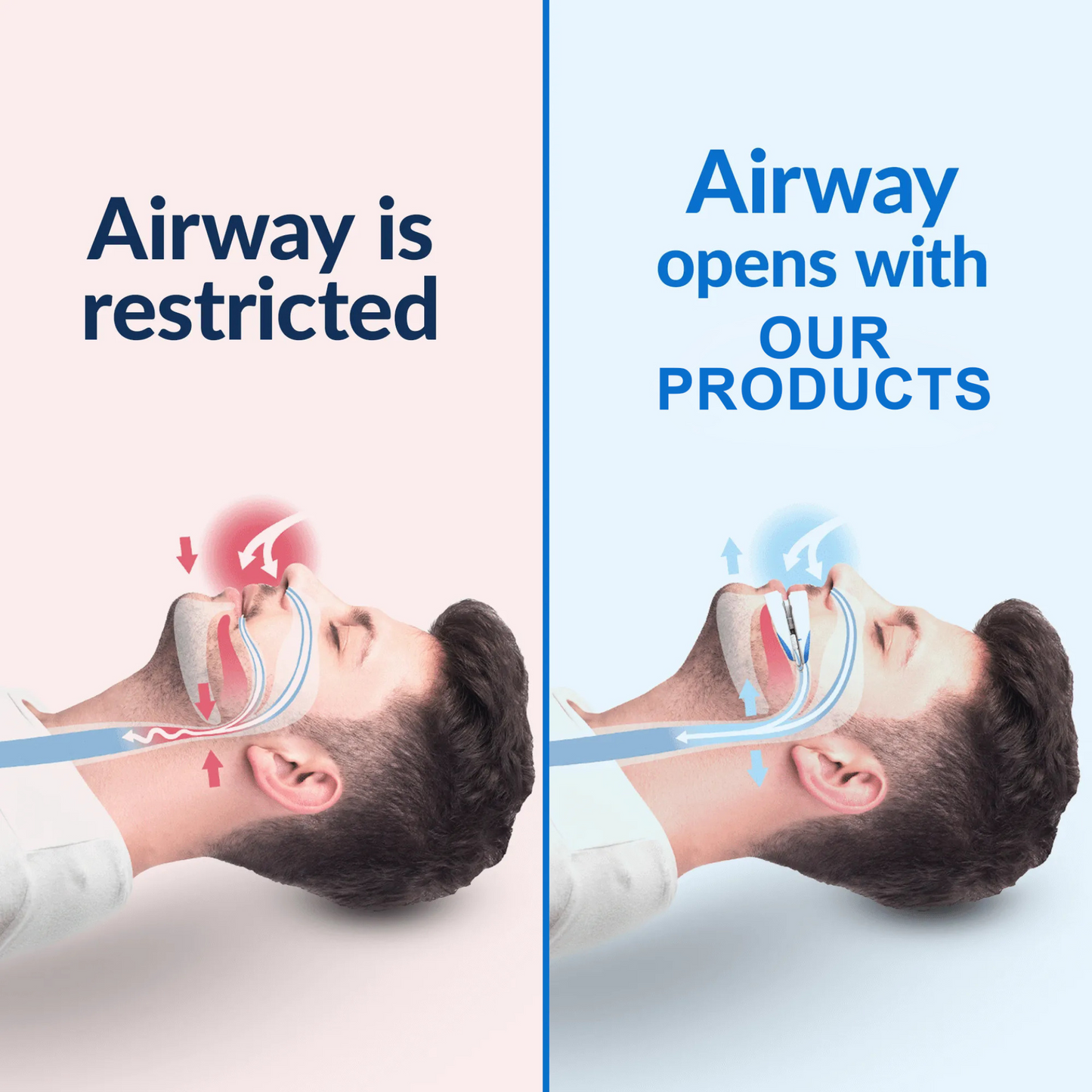 Twiia Mouth Guard - Sleep Apnea & Anti-Snoring